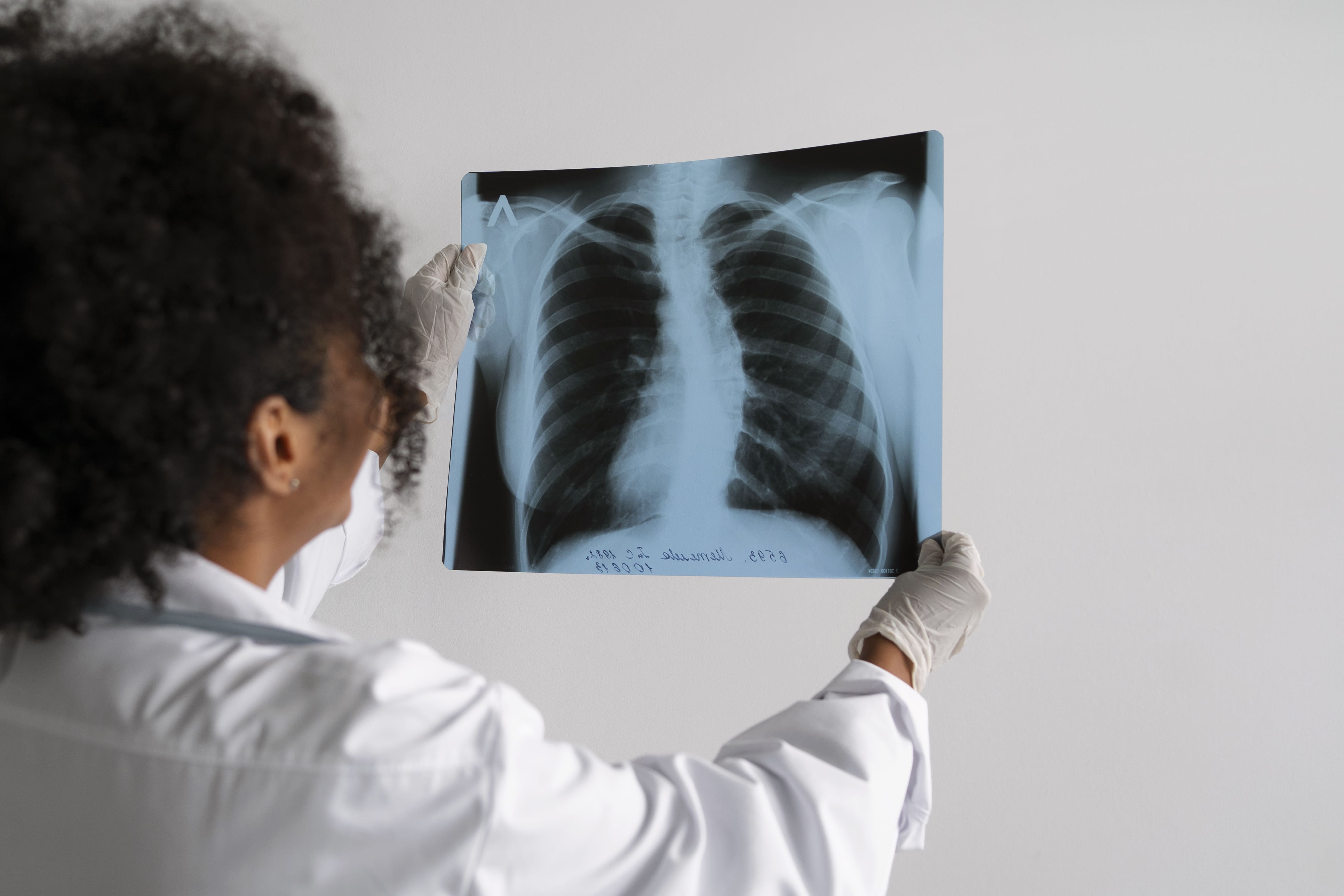 Médica analisa radiografia de pulmão