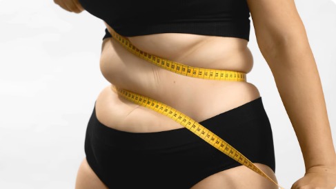 Foto de mulher com sobrepeso com uma fita métrica em torno do abdômen