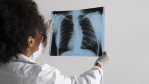 Médica analisa radiografia de pulmão